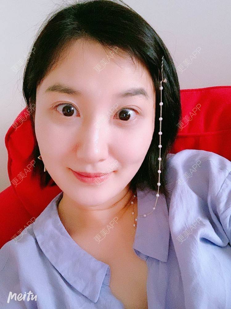 更美 - 更美用户v4fdzYgBRM的胶原蛋白淡化黑眼圈经验 | 胶原蛋白淡化黑眼圈 | 北京