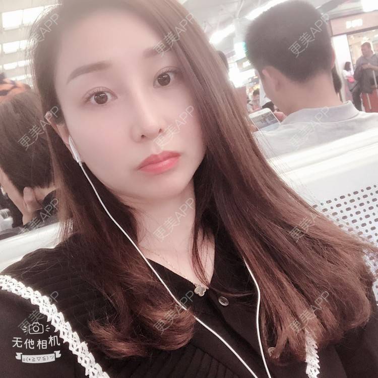 更美 - 蒙蒙噜噜噜的双眼皮修复经验 | 上海 | 双眼皮修复