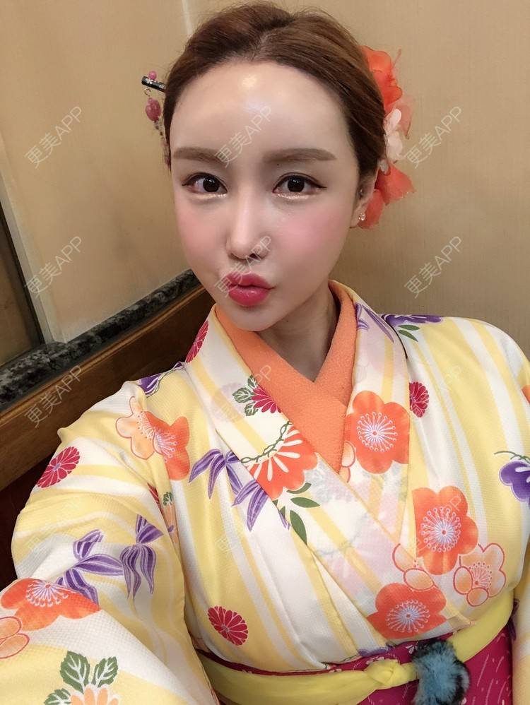 更美 - 素素酱的卧蚕修复经验 | 卧蚕修复 | 首尔
