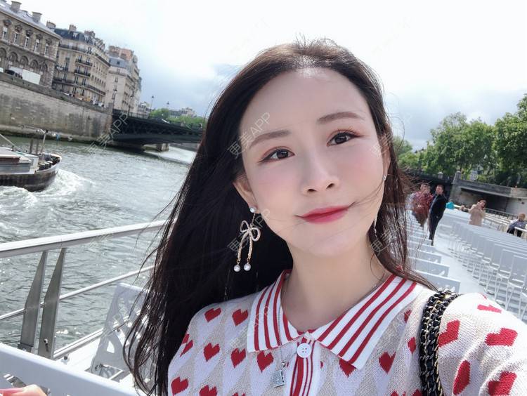 更美 - 兰质慧心的自体脂肪丰苹果肌经验 | 上海 | 自体脂肪丰苹果肌 | 视频日记 | 自体脂肪丰面颊 | 自体脂肪垫下巴