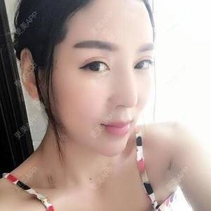 更美 - 更美用户zO6r8Ipolz的吸脂瘦脸经验 | 南昌 | 吸脂瘦脸