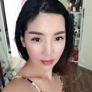 更美 - 更美用户zO6r8Ipolz的吸脂瘦脸经验 | 南昌 | 吸脂瘦脸