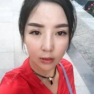 更美 - 更美用户zO6r8Ipolz的吸脂瘦脸经验 | 南昌 | 吸脂瘦脸