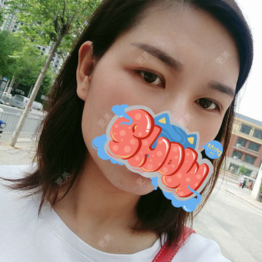 杨丽 医生