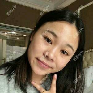 更美 - 情深深，雨濛濛的激光淡斑经验 | 激光淡斑 | 南京