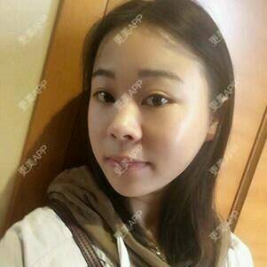 更美 - 情深深，雨濛濛的激光淡斑经验 | 激光淡斑 | 南京