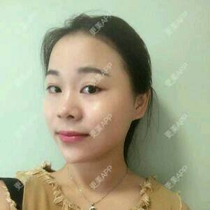 更美 - 情深深，雨濛濛的激光淡斑经验 | 激光淡斑 | 南京