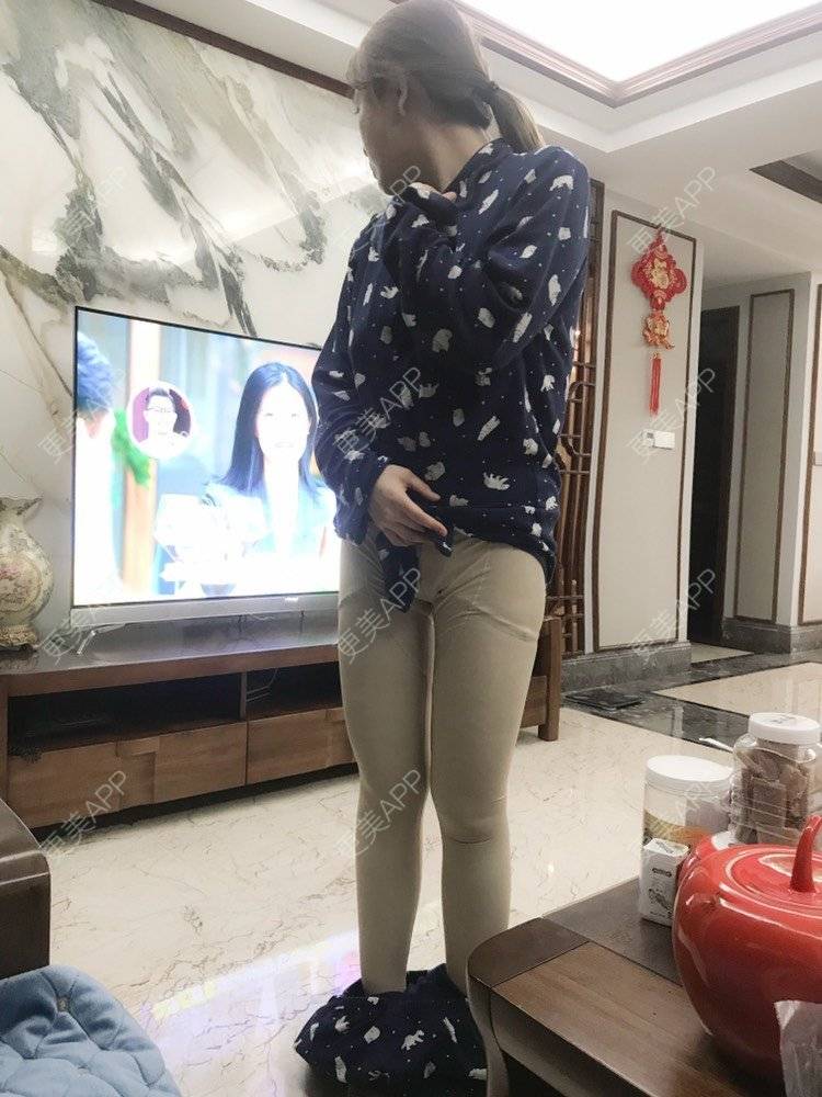 更美 - 夹心巧克力的自体脂肪丰臀经验 | 自体脂肪身体塑形 | 自体脂肪丰臀 | 吸脂塑臀 | 胶原蛋白丰臀 | 假体丰臀