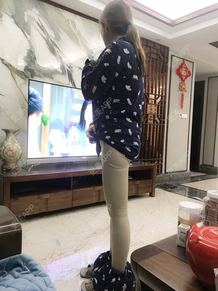 更美 - 夹心巧克力的自体脂肪丰臀经验 | 自体脂肪身体塑形 | 自体脂肪丰臀 | 吸脂塑臀 | 胶原蛋白丰臀 | 假体丰臀