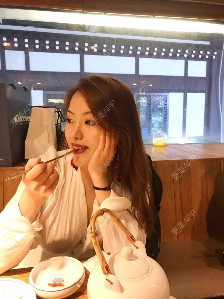 更美 - 夹心巧克力的自体脂肪丰臀经验 | 自体脂肪身体塑形 | 自体脂肪丰臀 | 吸脂塑臀 | 胶原蛋白丰臀 | 假体丰臀