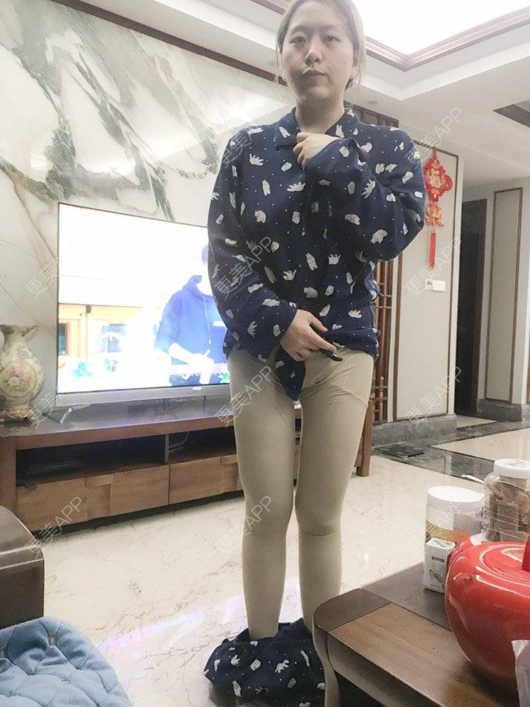 更美 - 夹心巧克力的自体脂肪丰臀经验 | 自体脂肪身体塑形 | 自体脂肪丰臀 | 吸脂塑臀 | 胶原蛋白丰臀 | 假体丰臀