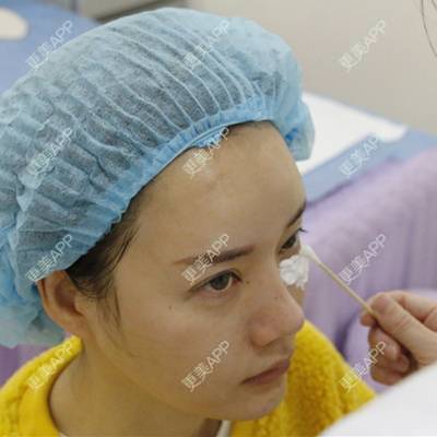 更美 - 灬紫色金城灬战队的玻尿酸卧蚕经验 | 玻尿酸卧蚕 | 深圳