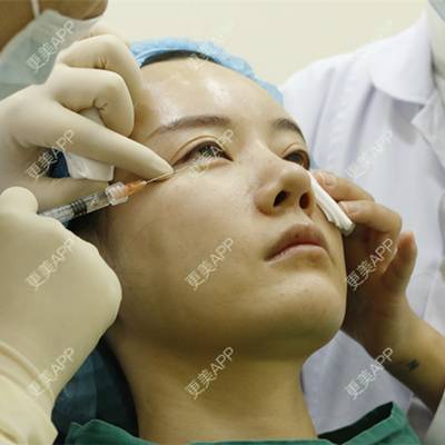 更美 - 灬紫色金城灬战队的玻尿酸卧蚕经验 | 玻尿酸卧蚕 | 深圳