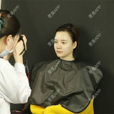 更美 - 灬紫色金城灬战队的玻尿酸卧蚕经验 | 玻尿酸卧蚕 | 深圳