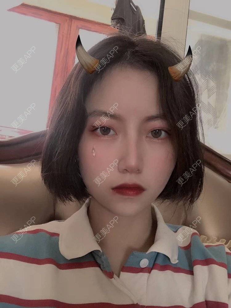 更美 - 更美用户TxQNRz4ppB的手术缩鼻头经验 | 手术缩鼻头 | 上海 | 视频日记