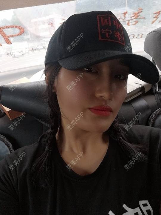 更美 - 淑芳宅_斋的除皱瘦脸经验 | 除皱瘦脸 | 长沙
