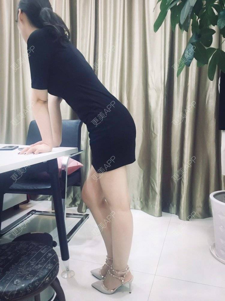 更美 - 更美用户CQFZ0nNp0z的臀部经验 | 自体脂肪丰臀 | 胶原蛋白丰臀 | 射频溶脂塑臀 | 臀部 | 腰腹吸脂 | 吸脂瘦大腿 | 手臂吸脂 | 吸脂塑臀 | 假体丰臀