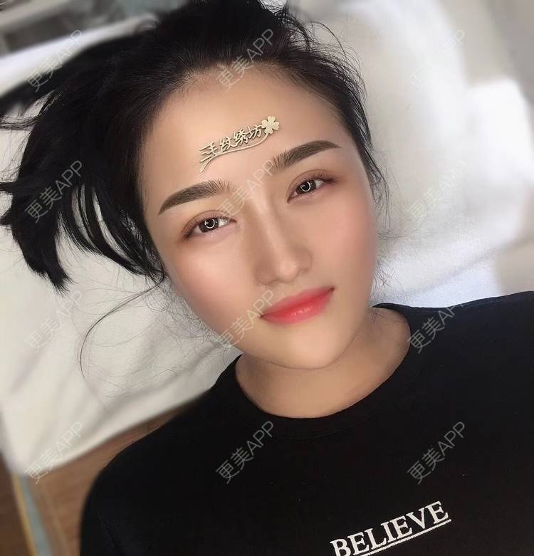 更美 - 淑芳宅_斋的除皱瘦脸经验 | 除皱瘦脸 | 长沙