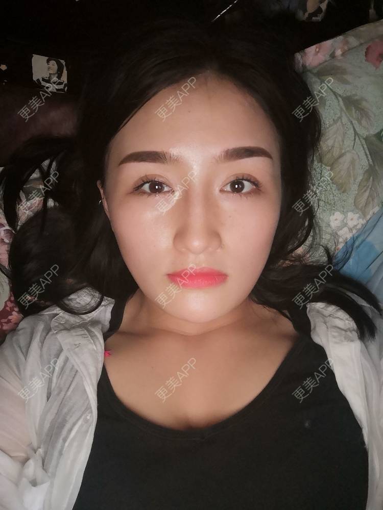 更美 - 淑芳宅_斋的除皱瘦脸经验 | 除皱瘦脸 | 长沙