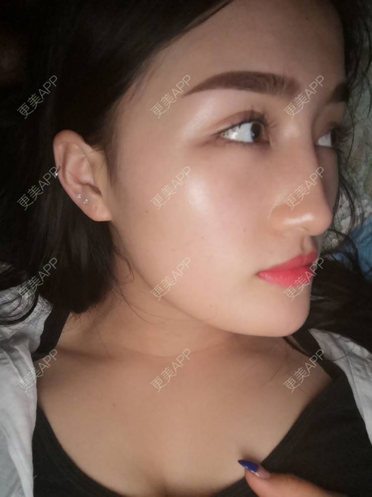 更美 - 淑芳宅_斋的除皱瘦脸经验 | 除皱瘦脸 | 长沙