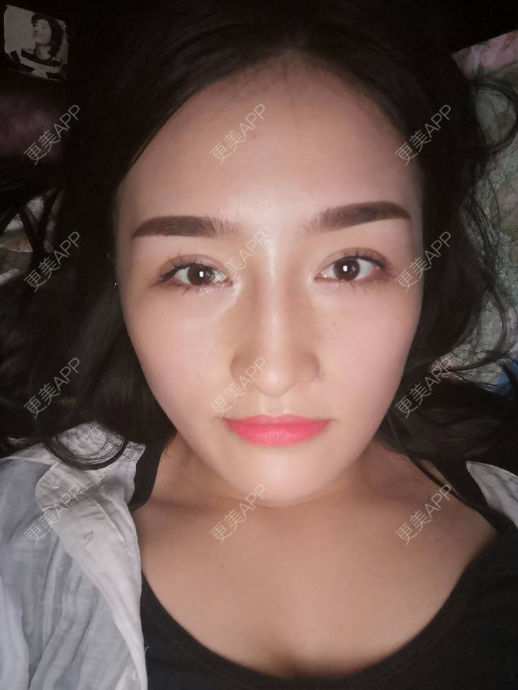更美 - 淑芳宅_斋的除皱瘦脸经验 | 除皱瘦脸 | 长沙