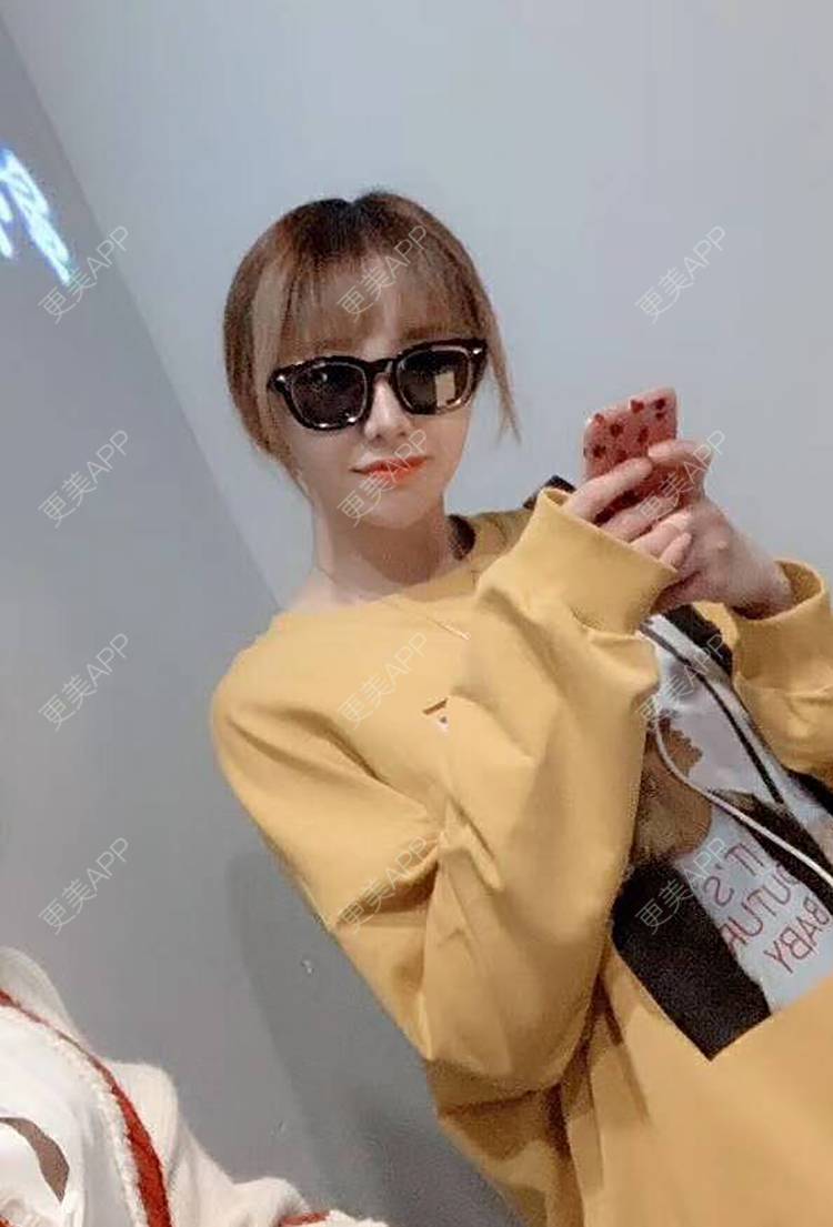 更美 - 更美用户I4G4fnb0pM的吸脂瘦脸经验 | 天津 | 吸脂瘦脸