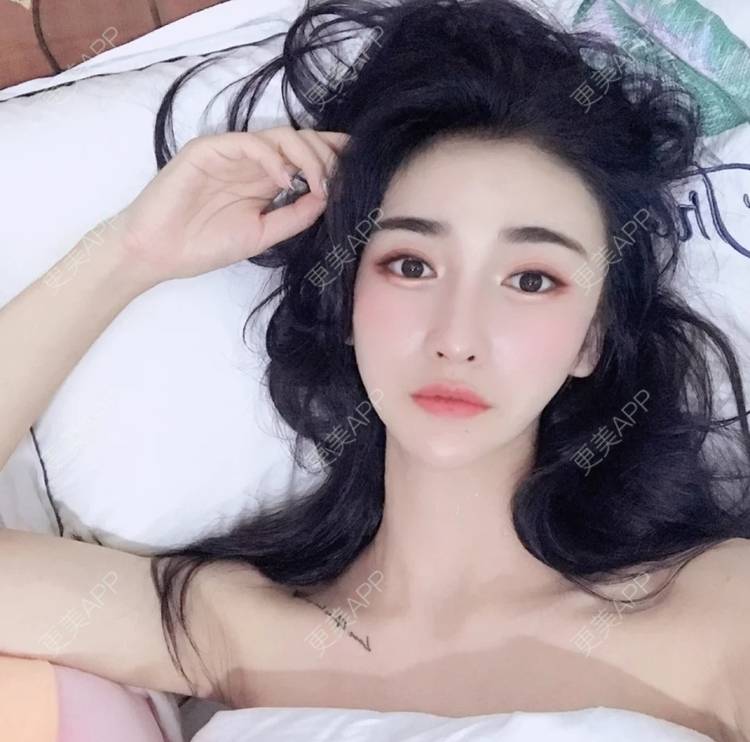更美 - 更美用户b4RCeaeNIP的胶原蛋白丰面颊经验 | 胶原蛋白丰面颊 | 杭州