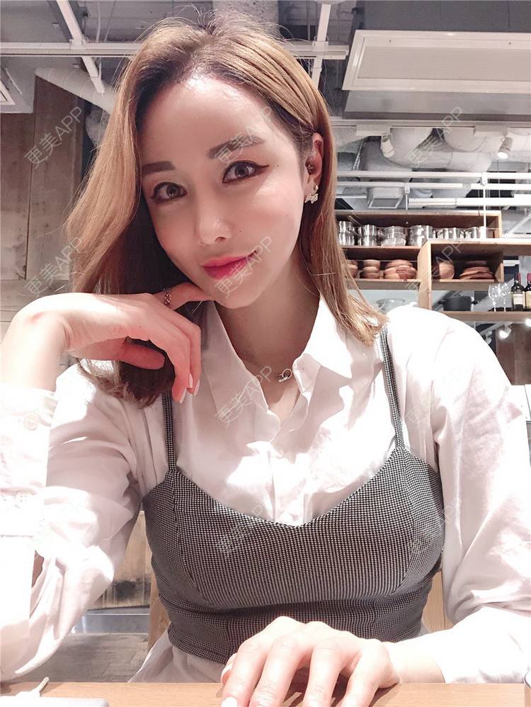 更美 - 素素酱的卧蚕修复经验 | 卧蚕修复 | 首尔