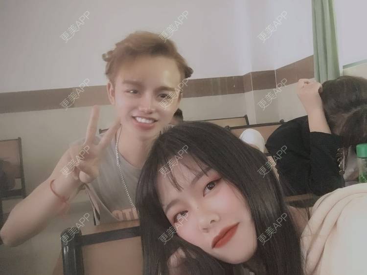 更美 - 更美用户rLJusWfgfC的面部脱毛经验 | 面部脱毛 | 武汉