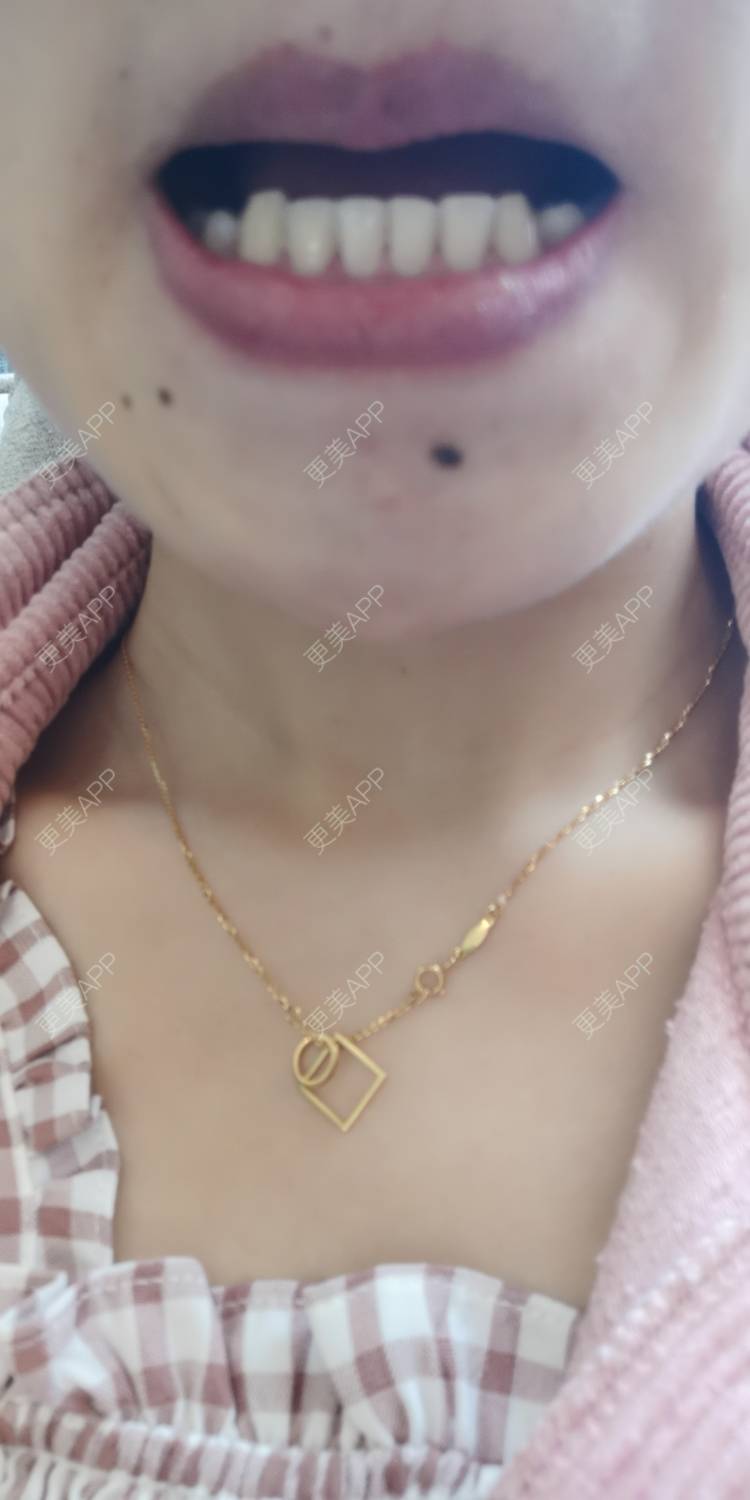 更美 - 更美用户yWgR3M4ypQ的牙齿矫正经验 | 视频日记 | 牙齿矫正 | 上海 | 美购日记