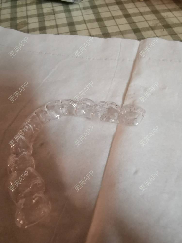 更美 - 更美用户yWgR3M4ypQ的牙齿矫正经验 | 视频日记 | 牙齿矫正 | 上海 | 美购日记