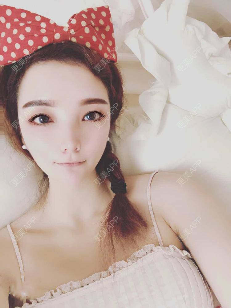 更美 - 更美用户EWqDuvHmIb的自体脂肪丰面颊经验 | 自体脂肪丰面颊 | 成都