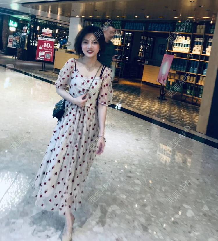 更美 - 爱跑步的蜗牛的自体脂肪全面部填充经验 | 广州 | 自体脂肪全面部填充 | 自体脂肪隆鼻 | 玻尿酸