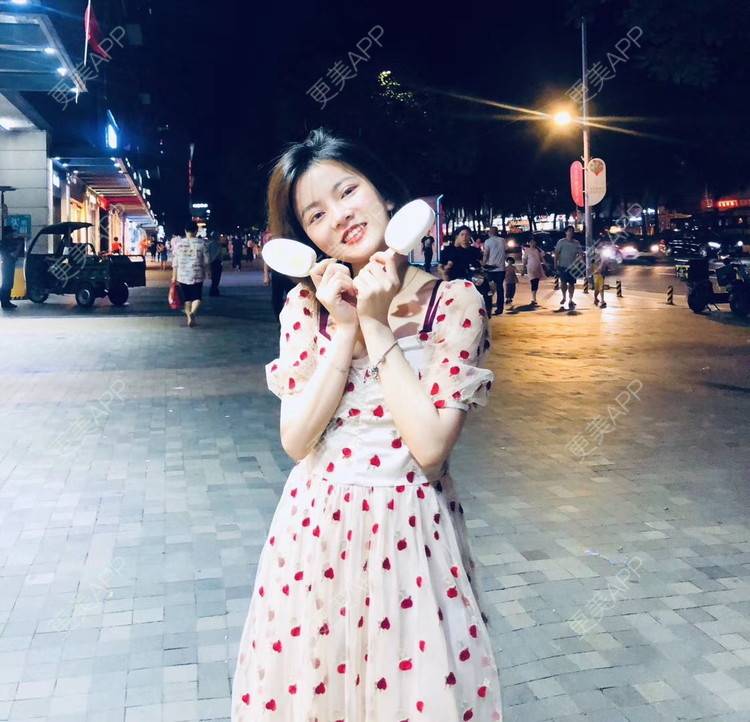 更美 - 爱跑步的蜗牛的自体脂肪全面部填充经验 | 广州 | 自体脂肪全面部填充 | 自体脂肪隆鼻 | 玻尿酸