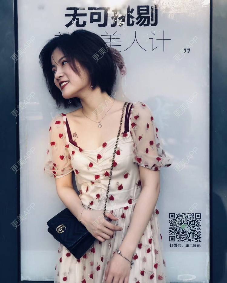 更美 - 爱跑步的蜗牛的自体脂肪全面部填充经验 | 广州 | 自体脂肪全面部填充 | 自体脂肪隆鼻 | 玻尿酸