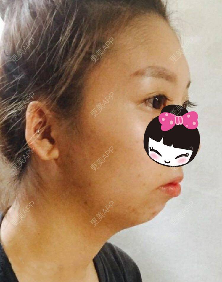 更美用户g0qaa1pcyd的下颌角日记