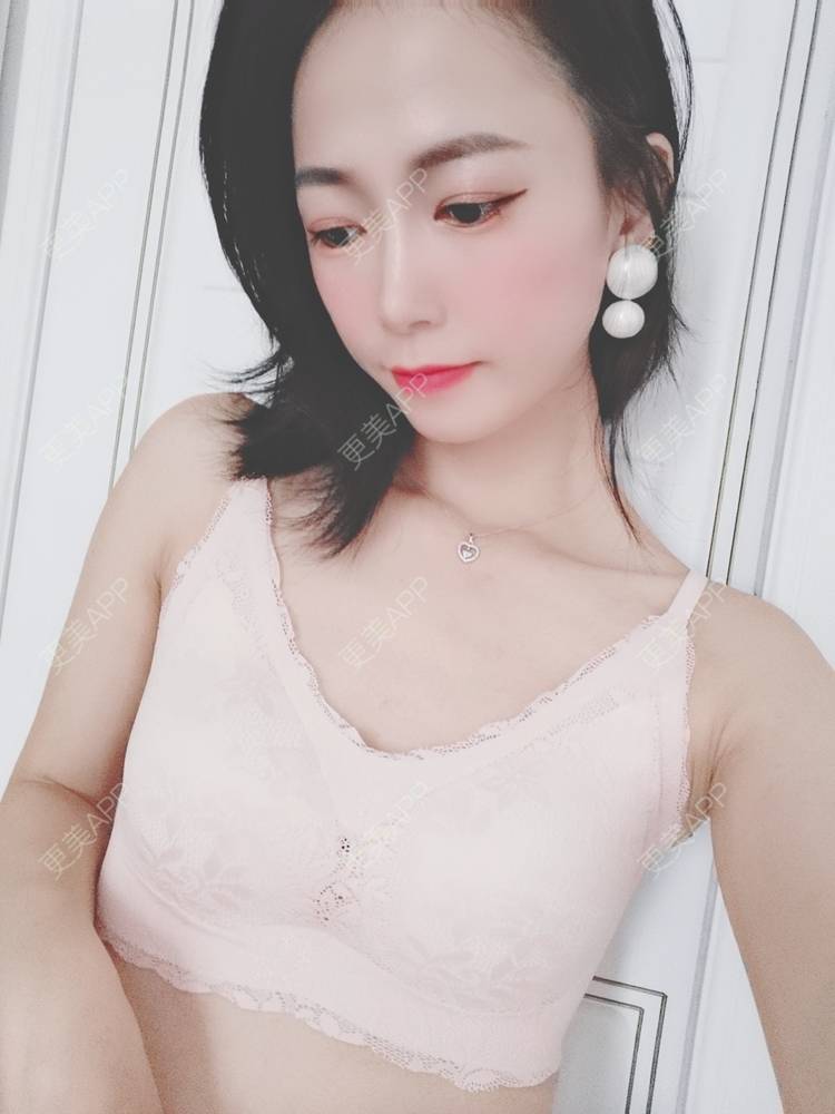 更美 - 更美用户y1zfD0qgXq的玻尿酸苹果肌经验 | 玻尿酸苹果肌 | 抚州