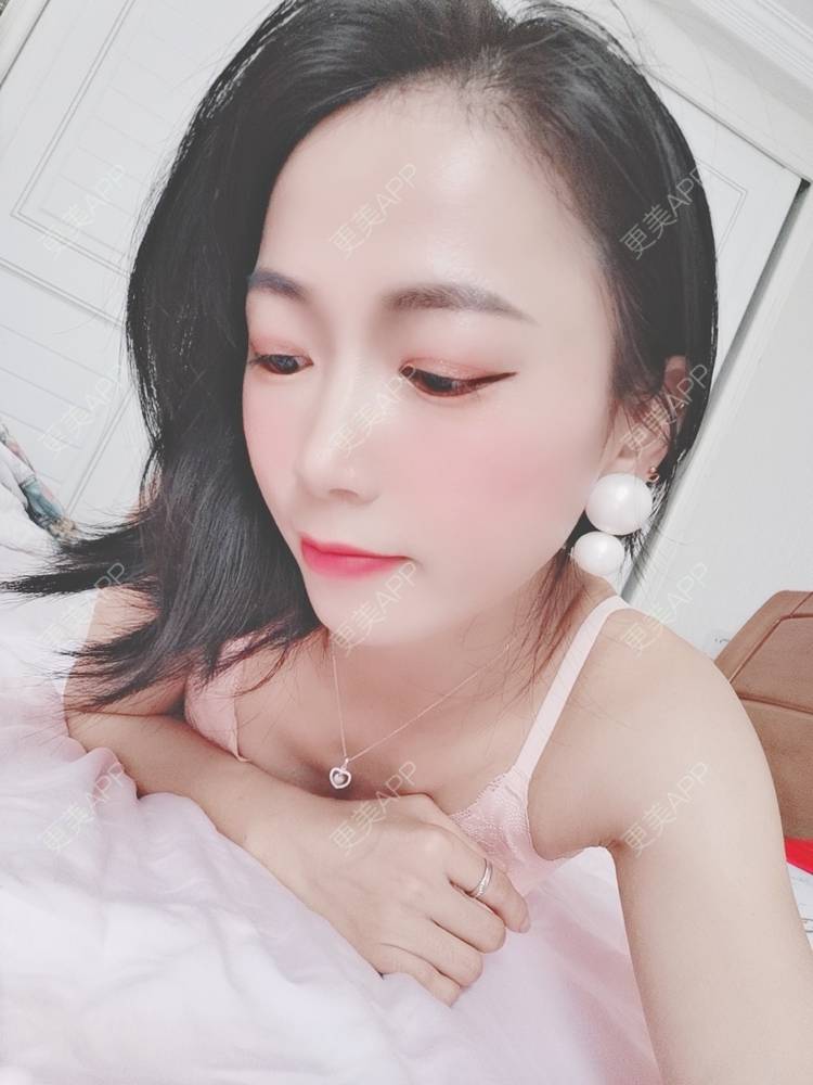 更美 - 更美用户y1zfD0qgXq的玻尿酸苹果肌经验 | 玻尿酸苹果肌 | 抚州