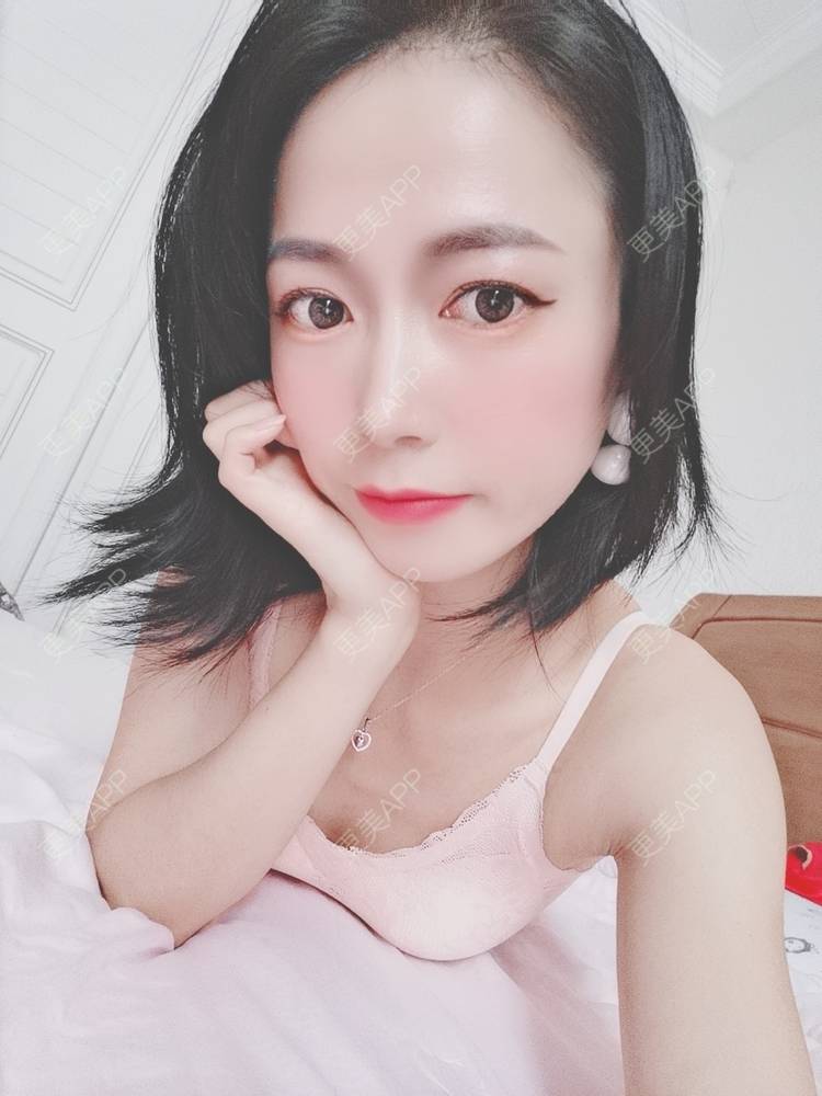 更美 - 更美用户y1zfD0qgXq的玻尿酸苹果肌经验 | 玻尿酸苹果肌 | 抚州