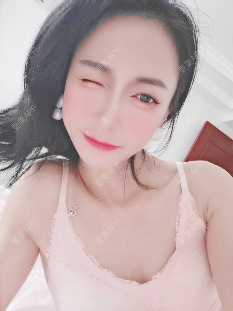 更美 - 更美用户y1zfD0qgXq的玻尿酸苹果肌经验 | 玻尿酸苹果肌 | 抚州