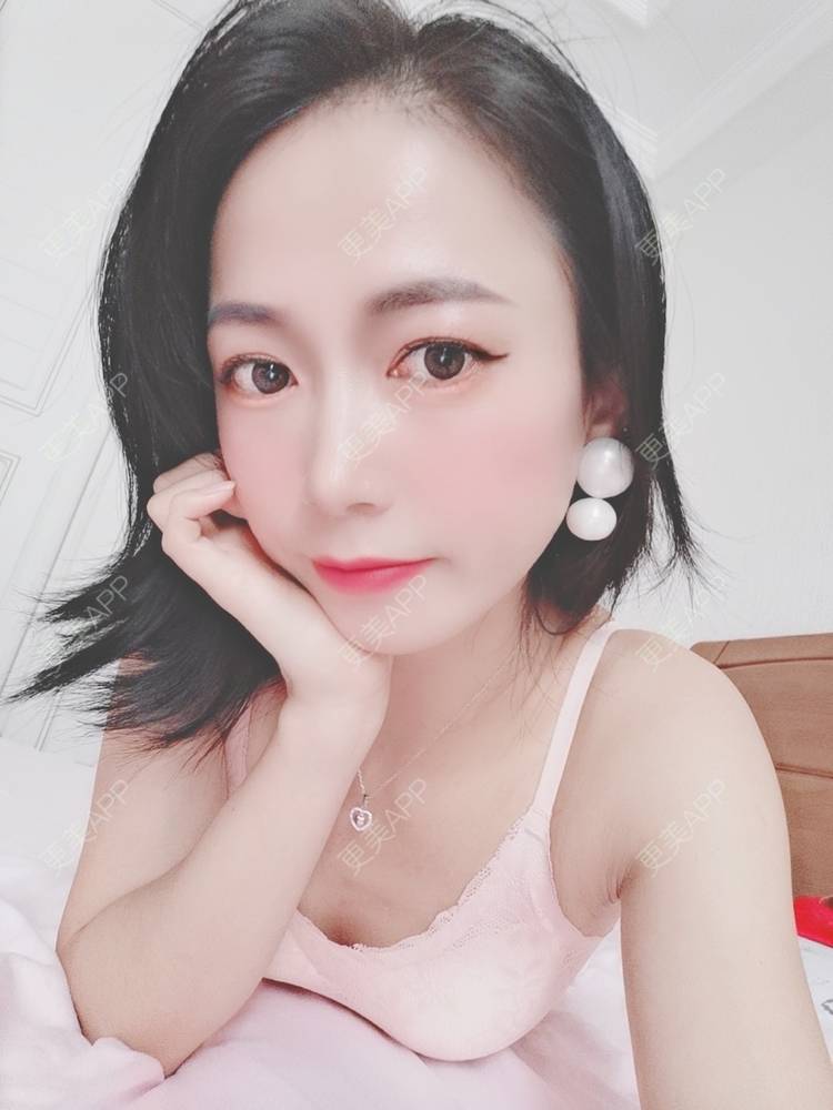 更美 - 更美用户y1zfD0qgXq的玻尿酸苹果肌经验 | 玻尿酸苹果肌 | 抚州
