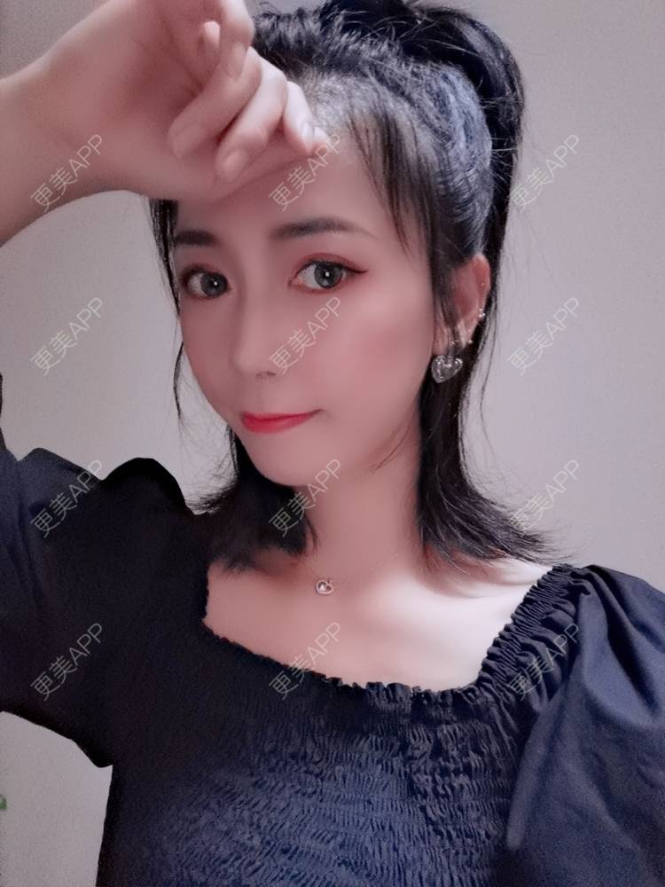 更美 - 更美用户y1zfD0qgXq的玻尿酸苹果肌经验 | 玻尿酸苹果肌 | 抚州