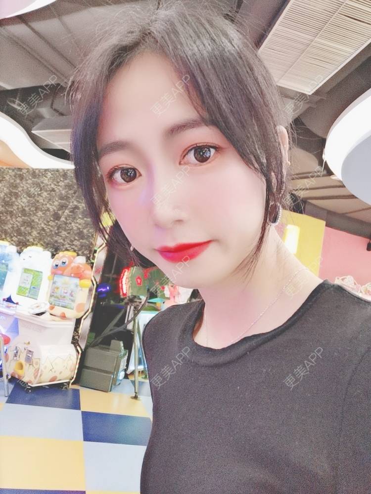 更美 - 更美用户y1zfD0qgXq的玻尿酸苹果肌经验 | 玻尿酸苹果肌 | 抚州