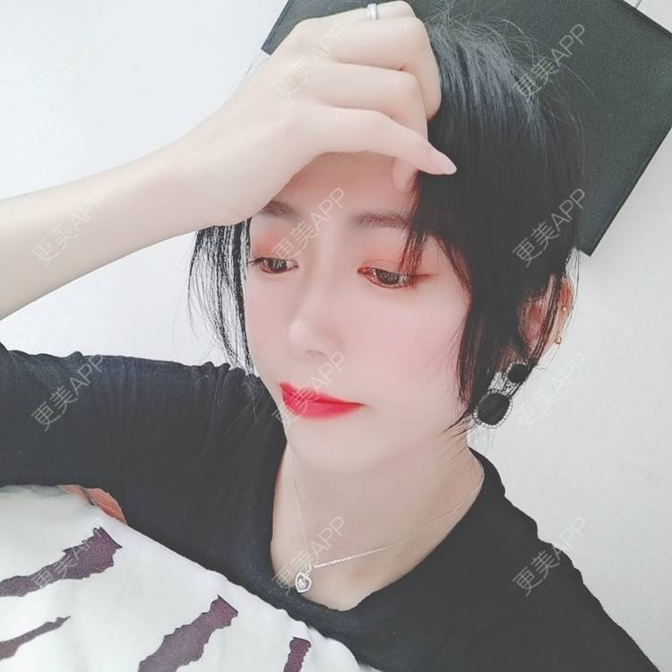 更美 - 更美用户y1zfD0qgXq的玻尿酸苹果肌经验 | 玻尿酸苹果肌 | 抚州