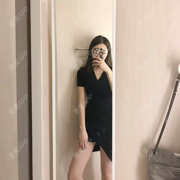 更美 - 凉心暖男人的比基尼脱毛经验 | 上海 | 比基尼脱毛
