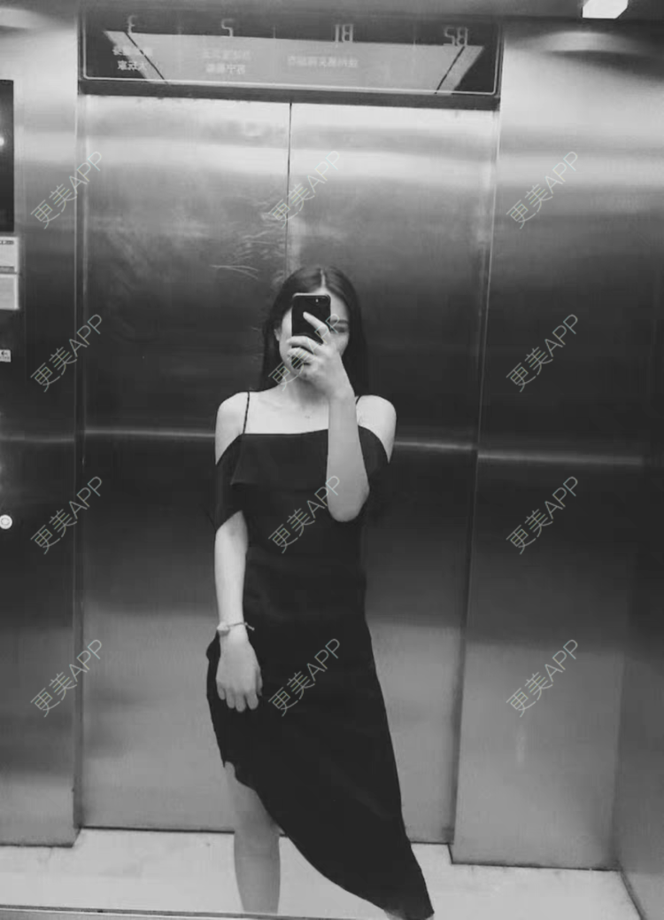 更美 - 凉心暖男人的比基尼脱毛经验 | 上海 | 比基尼脱毛