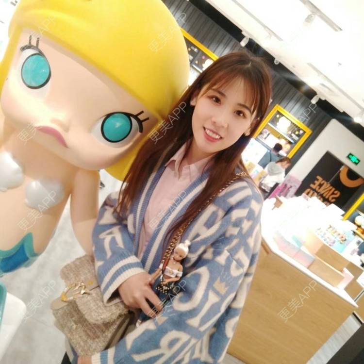 更美 - 更美用户YXs5bAlKu4的全切双眼皮经验 | 全切双眼皮 | 开内眼角 | 眼部多项