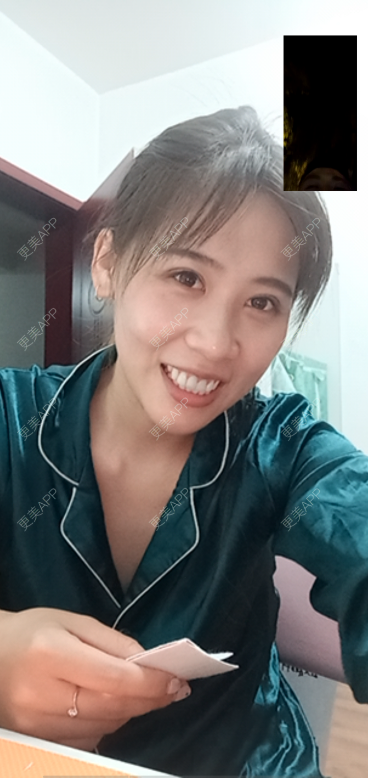 更美 - 更美用户YXs5bAlKu4的全切双眼皮经验 | 全切双眼皮 | 开内眼角 | 本溪 | 眼部多项