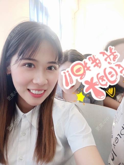 更美 - 更美用户YXs5bAlKu4的全切双眼皮经验 | 全切双眼皮 | 开内眼角 | 本溪 | 眼部多项