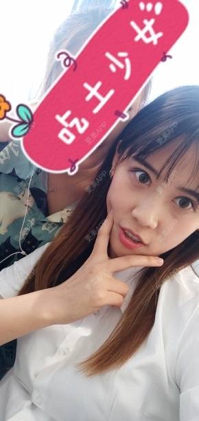 更美 - 更美用户YXs5bAlKu4的全切双眼皮经验 | 全切双眼皮 | 开内眼角 | 本溪 | 眼部多项